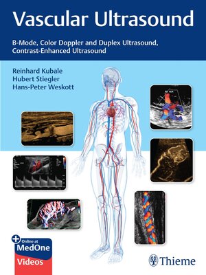 cover image of Vascular Ultrasound